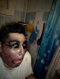 Из-за электронной сигареты он лишился 7 зубов