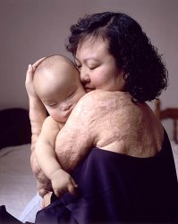 During the Vietnam War, there was a famous photograph of a young Vietnamese girl running along a road on fire from napalm...Joe McNally made this image of Phan and her baby many years later... :)