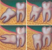 Так чего тут непонятного, места нет.
Хорошо еще, что удалять не пришлось.