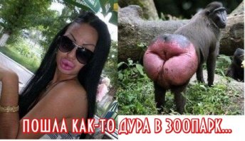 Бывшая жена Тимати и другие звезды инстаграма до и после пластики