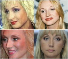Пост не слишком хорошо сделан. Бабкиной второе фото уже старое, сейчас она выглядит значительно хуже. Повалий и на первом и на втором фото после операций, поэтому большой разницы не видно, а по сравнению со старыми фото, он существенная. Орбакайте тоже первое фото уже не молодой, там может угол неудачный, у неё нос больше был. Паркер и сейчас считается в Голливуде далеко не красотой, тут скорее образ из 'секса в большом городе' играет. Ну и Дион назвать красавицей тоже вроде как нельзя, но тут талантище!