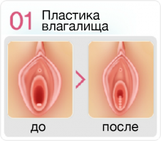 Вот что всем б Ледям на пользу....