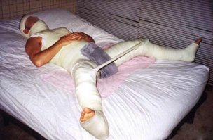  Смертельные трюки норвежского акробата