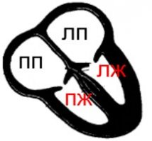 Ну на счет "сразу поймёте" - это Вы загнули....
Всё ведь зависит от плоскости сечения, присутствуют ли на рисунке артерии и т.п. 
Хотя если откинуть все лишние детали, оставить только 4 камеры сердца (причем - здорового) и упростить рисунок до схемы, то получим нечто похожее. Например, так