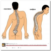 Справа настоящий рукожоп...