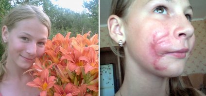 Так точно и минусят не представляющие какую реальную угрозу несут эти породистые убийцы. Вот когда пол задницы откусит или снимет скальп, тогда задумаются что это такое на самом деле.Пусть со своими детьми оставят поиграться. Любуйтесь и погладьте за это четвероногого бойцового "друга"