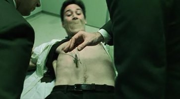 Вы удивитесь, когда узнаете, что оставило этот жуткий след на теле парня