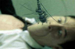 Вы удивитесь, когда узнаете, что оставило этот жуткий след на теле парня