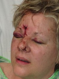 Болельщица получила шайбой от своей любимой команды.