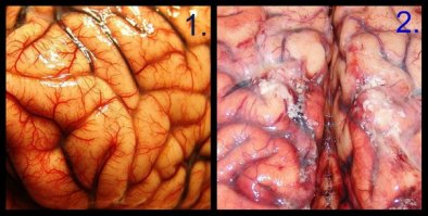 Водка не лучший помощник мозгу.