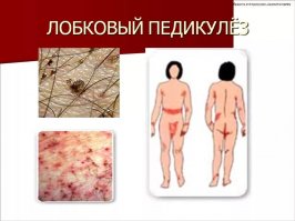 Энтомолог прививает людям любовь к насекомым, сажая их себе на лицо