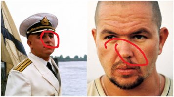 мичман ринопластику сделал?