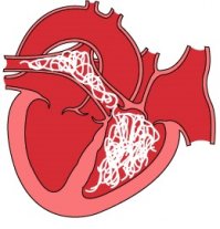 Свиные глисты.
Поражают сердце, например.