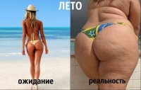 Девушка показала отрицательную сторону экстремальной потери веса