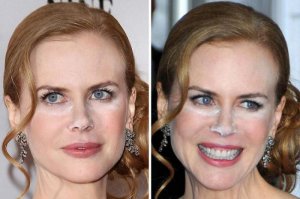 Эммм... Кокс?