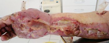 Страшнее СПИДа: болезни, лекарств от которых нет