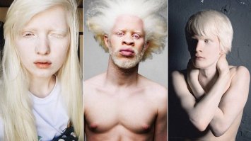 С такой необычной внешностью ноги и рост уже не актуальны. Главное что она - альбинос.