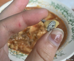 Она свои ногти видела вообще? У неё там внеземная жизнь под ногтём уже завелась. А шуруп проварился- стерильный.