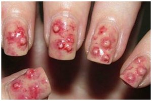 Отвратительно, неужели кому-то нравится.