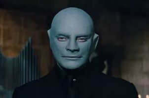 7 человек с самым необычным оттенком кожи