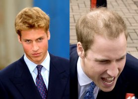 Вообще не понимаю причем тут статус? Волосы вроде не от этого выпадают...Принц ты, или не принц, стареешь? Получи лысину!!! В подарок блин...