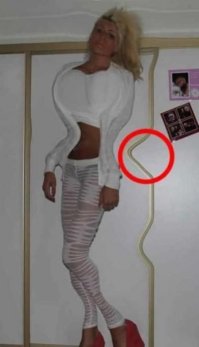 Ну, да, без этого кружочка-то и не догадались бы, что девушку изрядно покорёжило, возможно комбайном