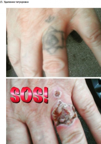 А что не так, веть татуировки нет!? Условие выполнено... =)