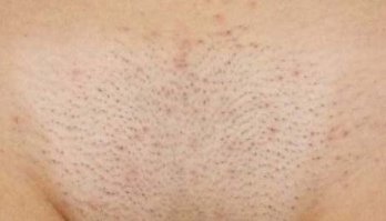 Мужчины, при ежедневном бритье, в течение жизни тратят 3 350 часов на сбривание 8,4 метров щетины. Мне одному показалось, что статистика о чём-то скромно умалчивает?