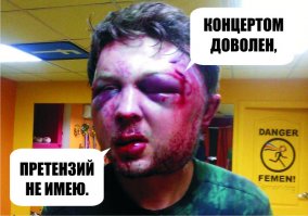 Охрана жестоко избила пьяную молодую пару на концерте «Ленинграда»