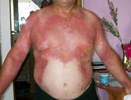 Животные и растения, способных причинить очень сильную боль