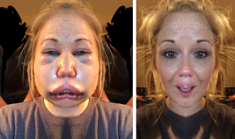 Что не так с этими фотографиями?