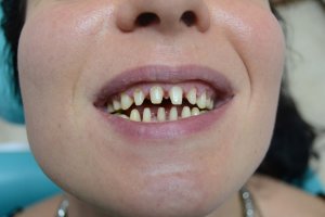 Это ненормально.
Должно быть как-то так: