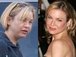 Как можно было забыть Рене Зеллвегер?