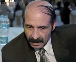 Tакая прича по-английски называется - Comb over ))))