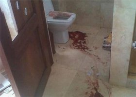 В некоторых случаях вполне могли (а может и были) быть переломы шейных позвонков, сотрясения мозга и порез крупных артерий и почти моментальная смерть от кровопотери (от унитаза например). 
После неудачного смертельного селфи на унитазе:)