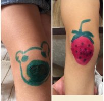 Когда зеленка не помогала - пришлось перейти на Кастеллани вперемешку с цинковой мазью. Дочь на асфальт упала и подхватила какую-то бактерию...