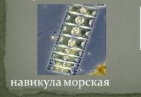 Похоже, что это предки морской навикулы - водоросли, имеющей панцирь из кремнезёма, который не разрушается после её отмирания, аки скелет:

Хотя... некоторые болваны могут принять их за "древние микросхемы" инопланетного происхождения и раздуть из этого целую б.лядскую сенсацию для жёлтой прессы: