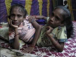 А потом рождаются вот такие дети и иони считают их божествами