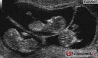 Мальчишки и девчонки, которым круто фортануло