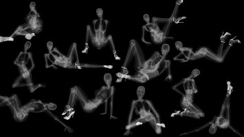 Забавные медицинские аномалии от мексиканских любителей фотошопа