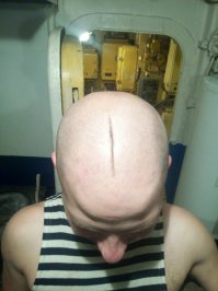 Если бы фотка была не в этой подборке, то решил бы, что это шрам на лысине.