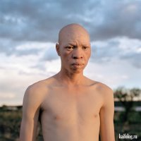 То есть мы все немного негры-альбиносы?
