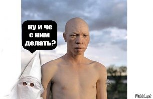 Удивительные портреты альбиносов Танзании, призывающие мир "проснуться"