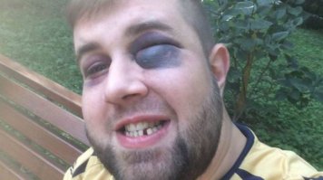 Полагаю, пухлик может начать карьеру "звезды" после такого боя)) Прославится еще больше. Пухлику, в общем-то, этого и надо) Тем более, ему не привыкать, если посмотреть его фотки "до":