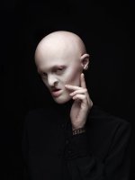 Шахолли Айерс, родившаяся без руки, успешно штурмует модельный бизнес