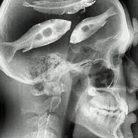 То, что вы не хотели бы обнаружить у себя в теле 