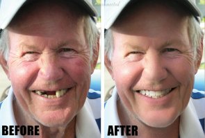 За другие фото не скажу, но здесь явно подфотошопили.