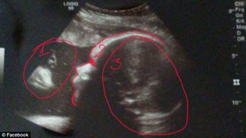 1 Реально Киркоров 
2 Лицо кого-то лысого в профиль
2 Бородатый и кучеряво-лохматый атлант с прокачаным торсом, по пояс