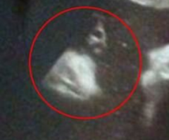 Пара "видит Иисуса" на УЗИ-снимке своего ребенка