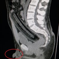 чето грустно за мужика